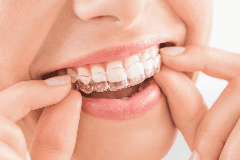 Cosmetic dentistry at Smile Lounge Dentistry in Milton