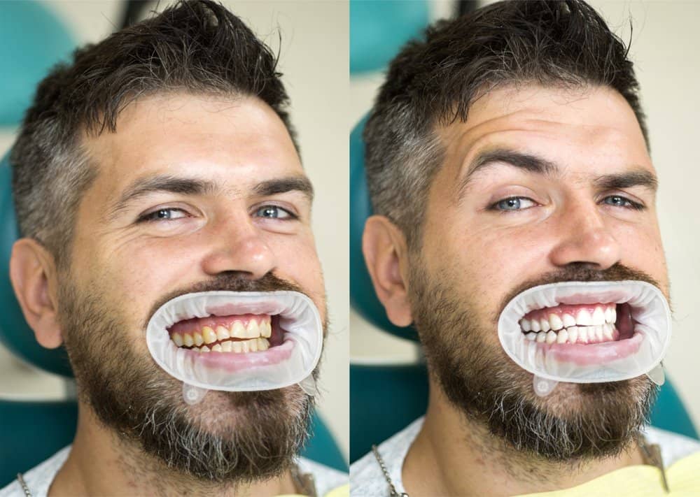 Patient smiling at Smile Lounge Dentistry Milton
