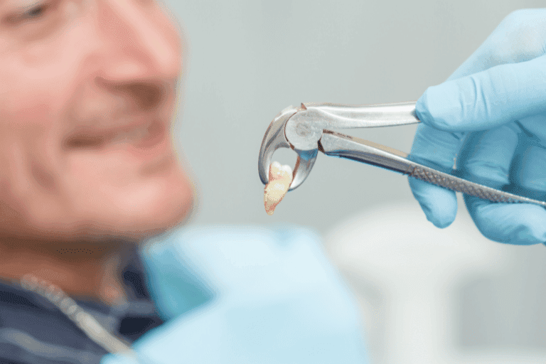 Wisdom Teeth Extraction at Smile Lounge