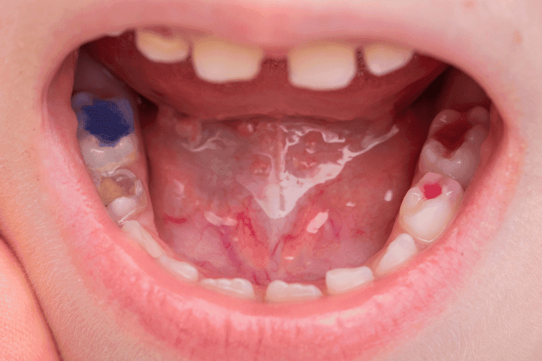 Children dentistry at Smile Lounge Dentistry in Milton