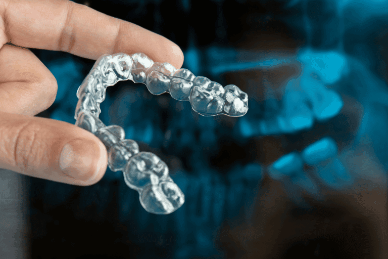 Dental Mouth Guards at Smile Lounge