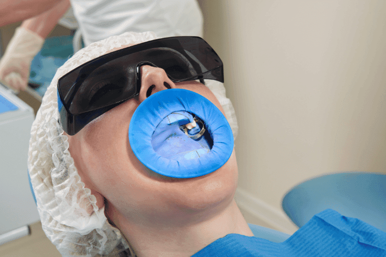 Flouride Treatments at Smile Lounge