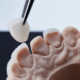 Dental Implant Cost in 2025: What to Expect, What’s Covered, and Smarter Ways to Save