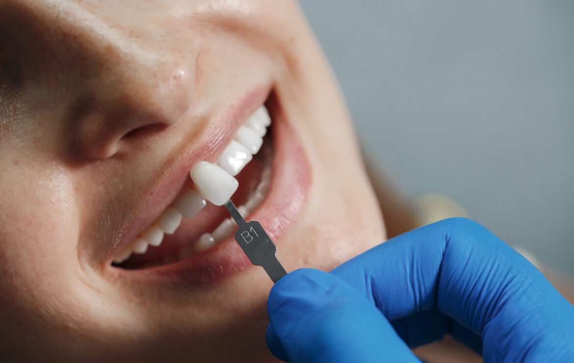 What Is a Dental Cap? Complete Guide to Dental Crowns in 2025