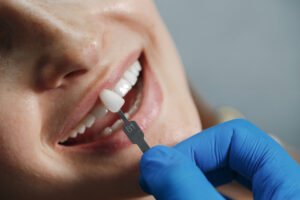 What Is a Dental Cap? Complete Guide to Dental Crowns in 2025