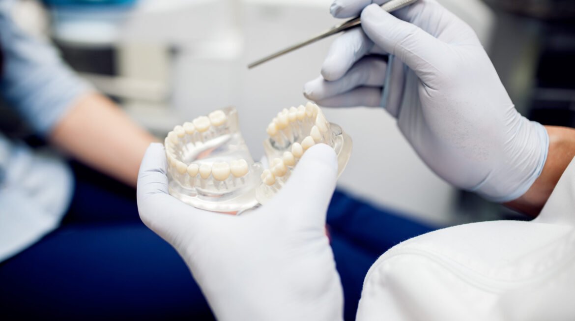How Much Does a Dental Bridge Cost Without Insurance in 2025?