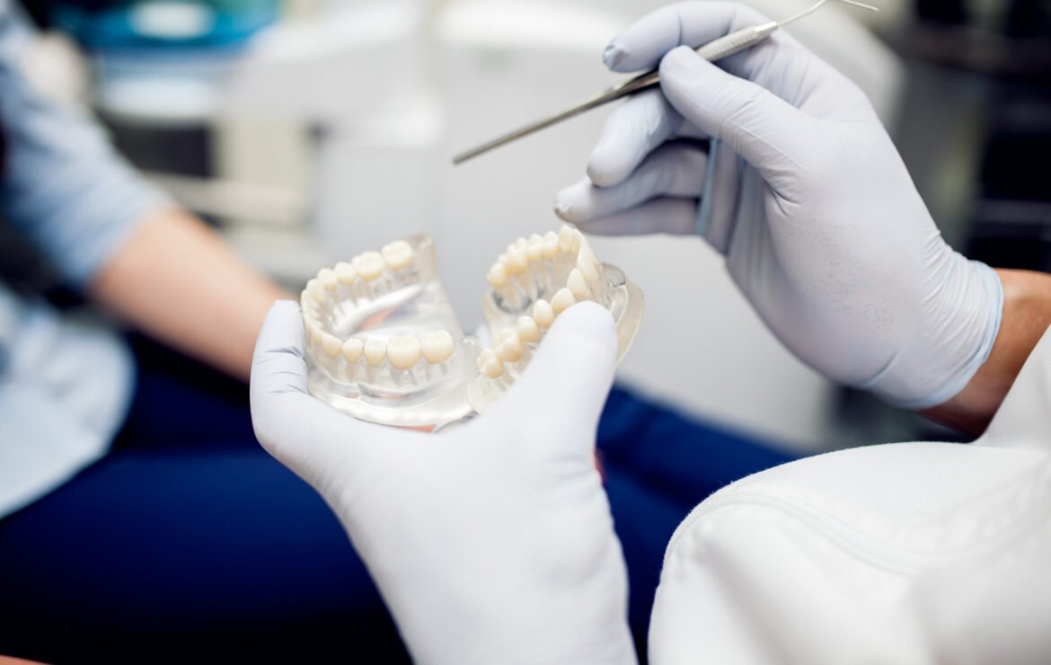 How Much Does a Dental Bridge Cost Without Insurance in 2025?