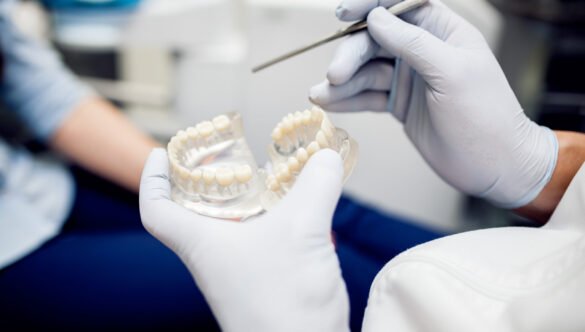 How Much Does a Dental Bridge Cost Without Insurance in 2025?