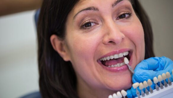 Dental Implants in Milton: Are They Right for You?