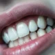 Gum Disease: Symptoms, Prevention & Treatment Options | Smile Lounge Dentistry