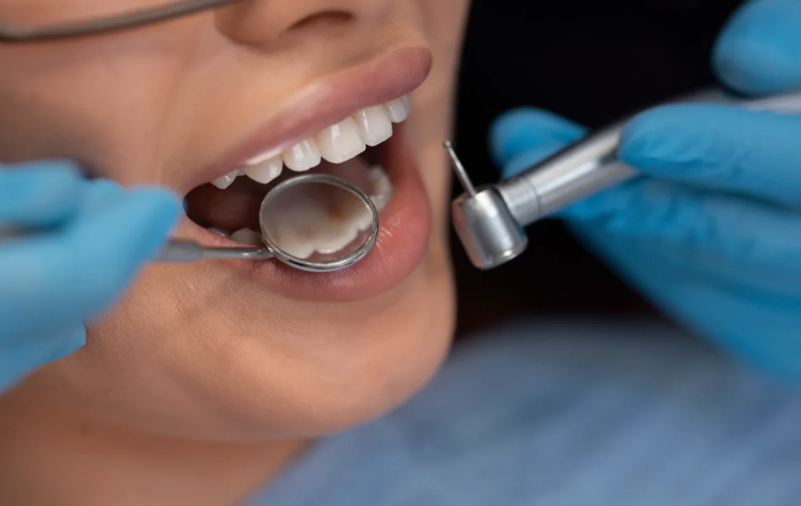 What Are the Types of Dental Fillings? A Complete Guide for Patients