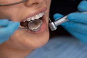 What Are the Types of Dental Fillings? A Complete Guide for Patients